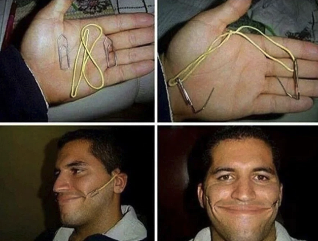 Man using two paperclips connected to two rubber bands behind his ears to make force a smile.
